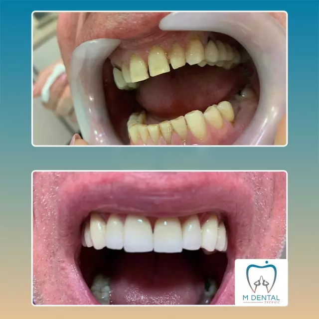 Complete dental services Budva (2).jpg