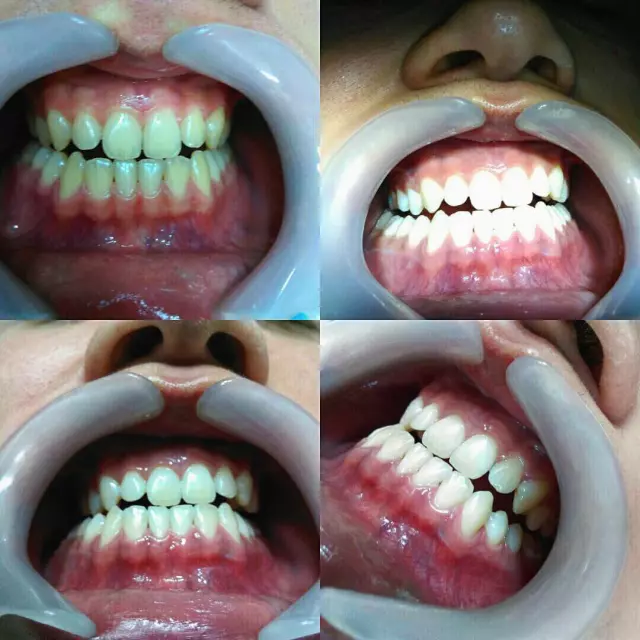 Complete dental services Budva (3).jpg