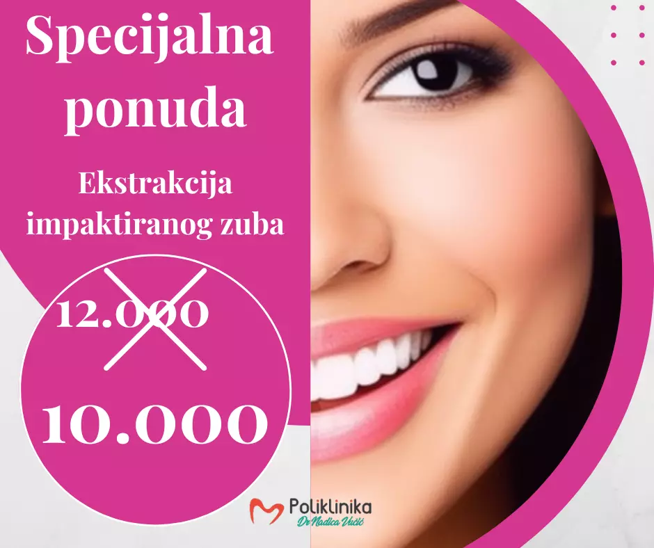 DentalniturizamSrbija3j