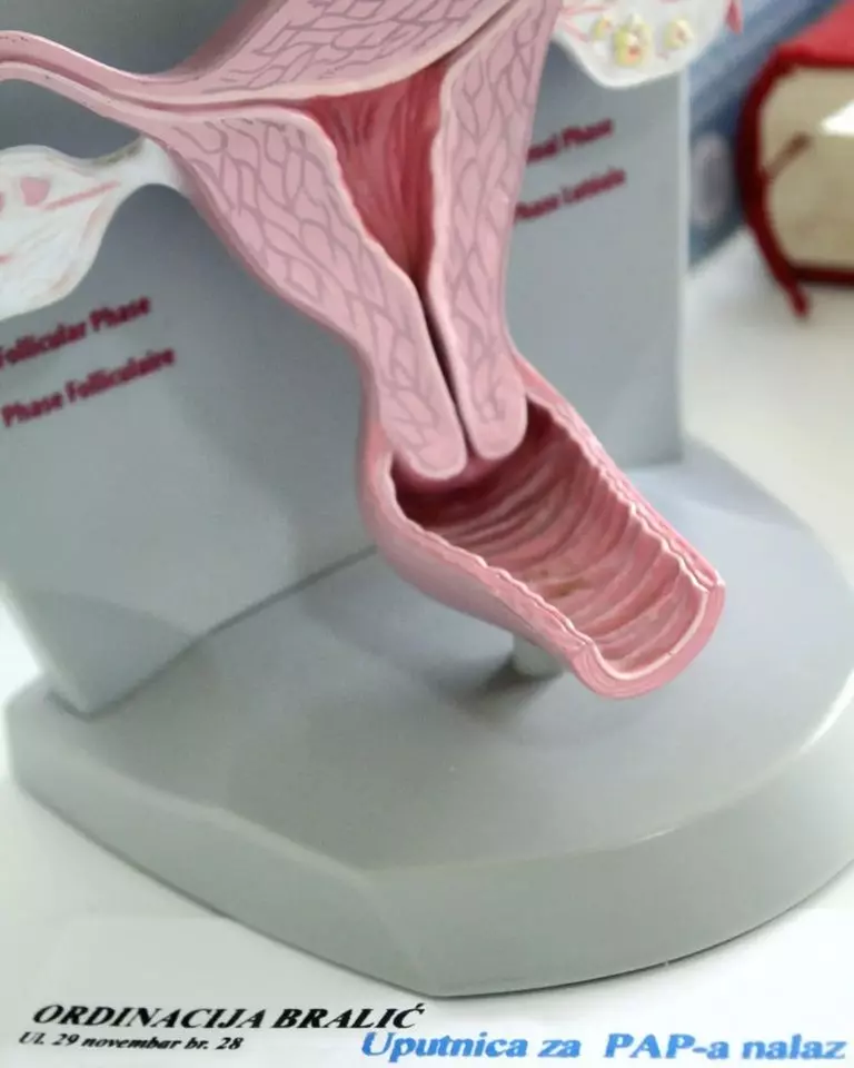 Kolposkopija-i-lečenje-menstrualnog-ciklusa-Rožaje