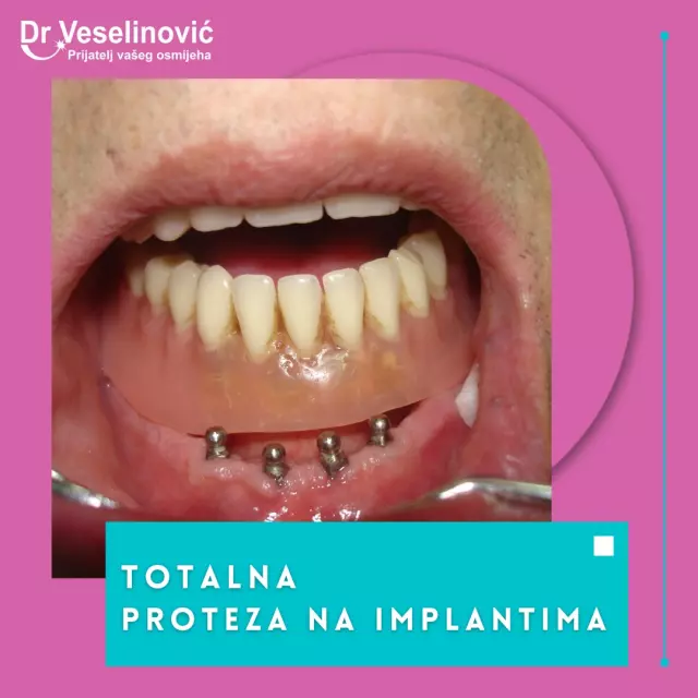 Najbolja stomatološka klinika  Herceg Novi (4).jpg