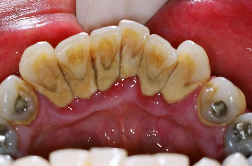 Opšta stomatološka ordinacija sa ortodoncijom Tivat (2).jpg