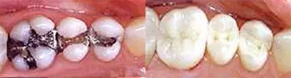 Opšta stomatološka ordinacija sa ortodoncijom Tivat (4).jpg