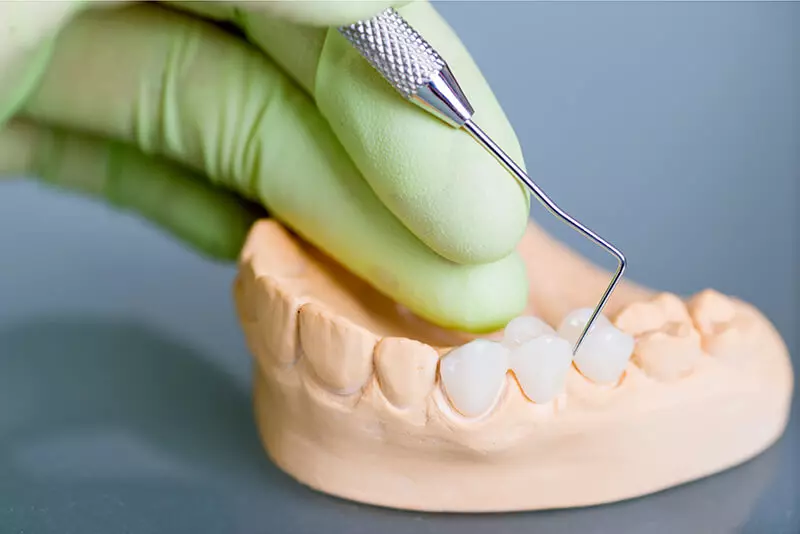 stomatoloska protetika stomatoloska ordinacija dr minic beograd.jpg